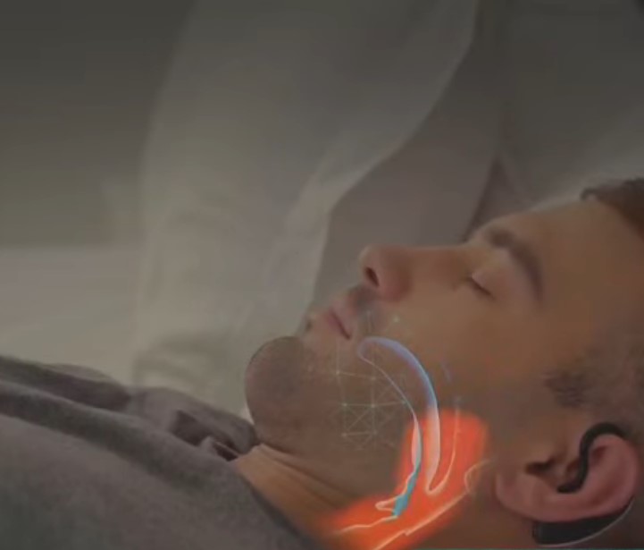 Anti-snoring Device